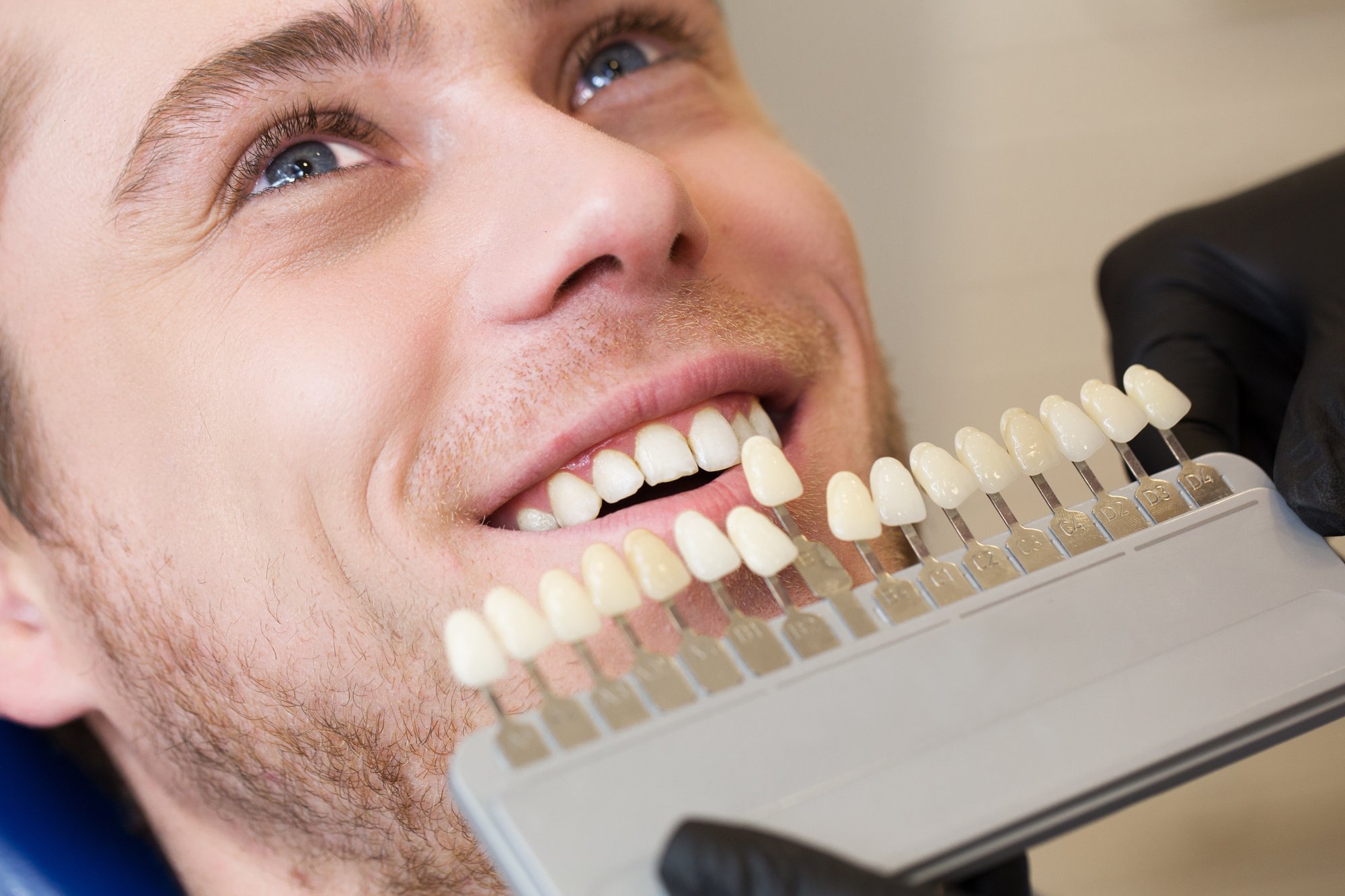 Your Complete Guide to Same-Day Crowns